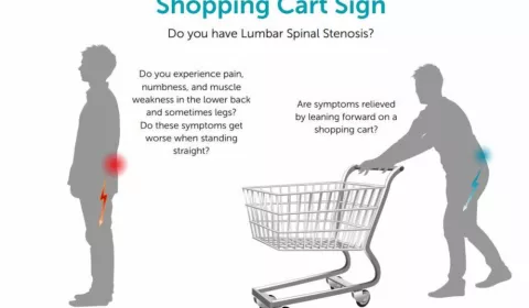 【新知】推購物車與脊椎狹窄