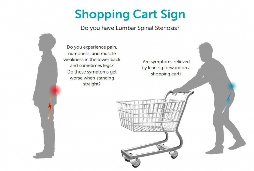img-【新知】推購物車與脊椎狹窄